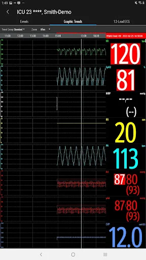 ดาวน์โหลด Mindray Mobile Viewer ล่าสุด – ระบบติดตามผู้ป่วยอัจฉริยะ - Screenshot 15
